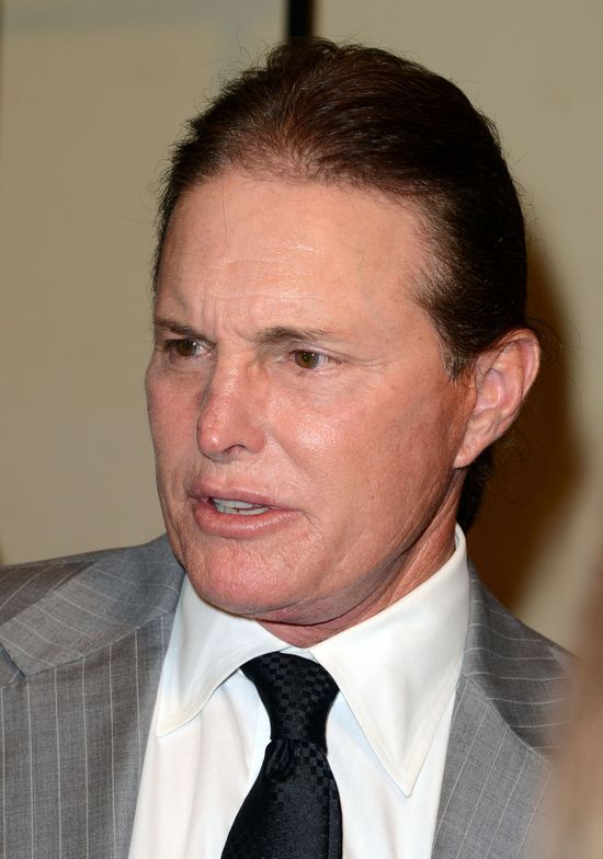 Bruce Jenner idzie na operację mniejszenia jabłka Adama!  
