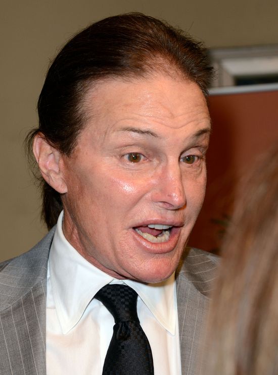 Bruce Jenner jest uzależniony od operacji plastycznych!