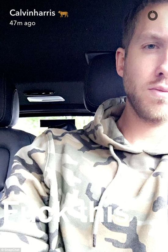 Calvin Harris pokazał twarz po wypadku (FOTO)