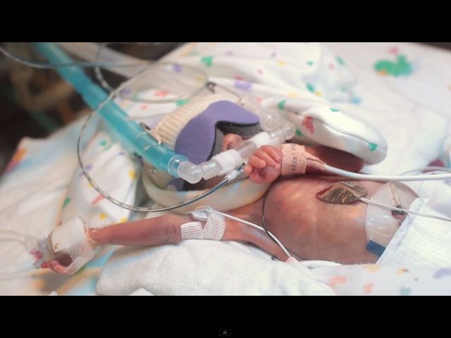 Wzruszająca historia wcześniaka podbija internet [VIDEO]