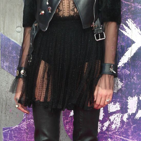 Mogła przykryć plamy po łuszczycy podkładem? Ona nie wsydzi się swojej choroby Mogła przykryć plamy po łuszczycy podkładem? Ona nie wsydzi się swojej choroby