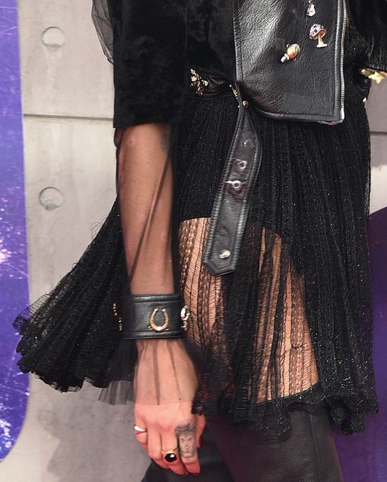 Mogła przykryć plamy po łuszczycy podkładem? Ona nie wsydzi się swojej choroby Mogła przykryć plamy po łuszczycy podkładem? Ona nie wsydzi się swojej choroby