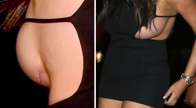 WPADKA tygodnia - blizna Charlotte, Nori robiąca mamie rozbierane fotki (SONDA)