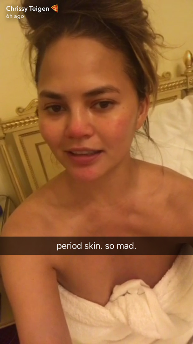 Chrissy Teigen pokazała, co dzieje się z jej twarzą podczas okresu