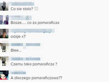 Natalia Siwiec przesadziła z opalaniem? (FOTO)