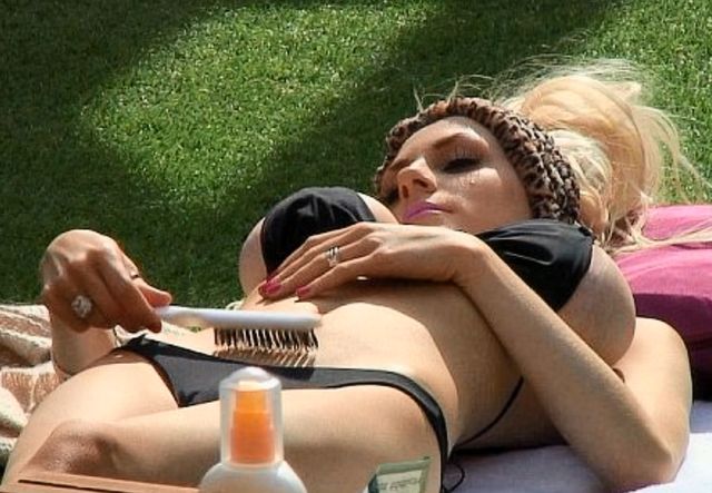 Spuchnięte i purpurowe piersi Courtney Stodden (FOTO)