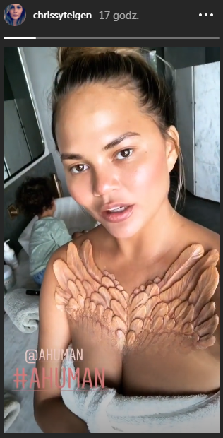 Coś dziwnego pojawiło się na dekolcie Chrissy Teigen! Czy to jakaś narośl?! 