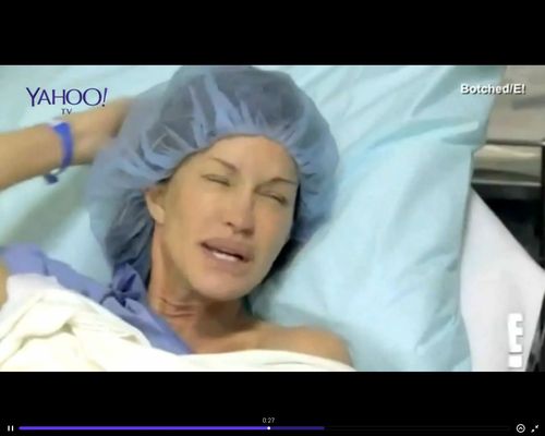 Zmieniła swoje 30-letnie implanty na oczach widzów [VIDEO]