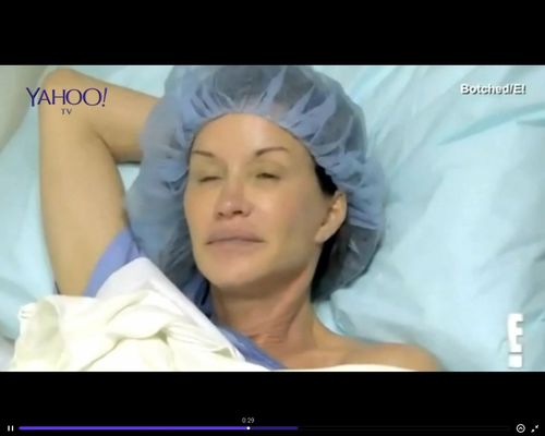 Zmieniła swoje 30-letnie implanty na oczach widzów [VIDEO]