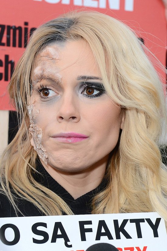 Koszmar! Zdeformowana twarz Dody (FOTO) Koszmar! Zdeformowana twarz Dody (FOTO)