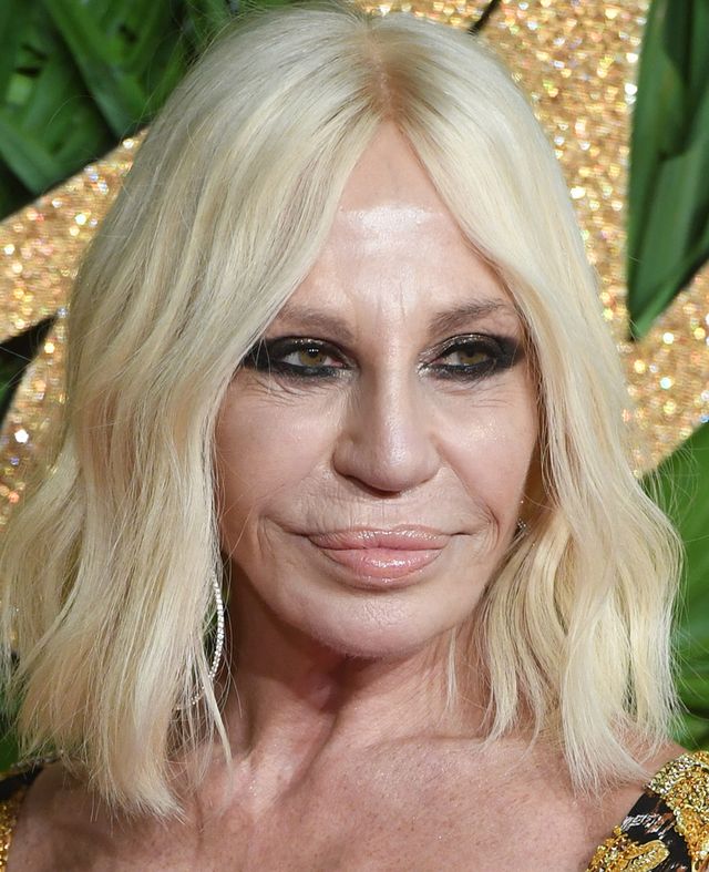 Obwisła skróa na ramionach wielkiej fanki operacji plastycznych (ZDJĘCIA)