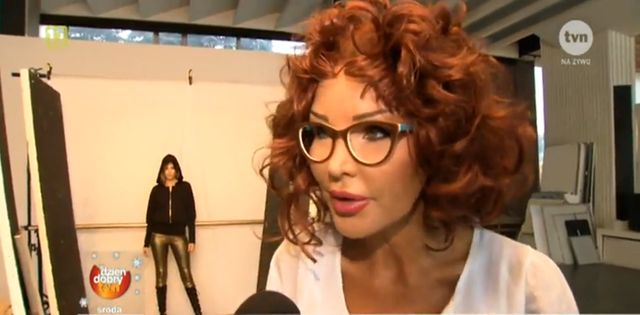 Opuchlizna twarzy Evy Minge to wynik choroby?