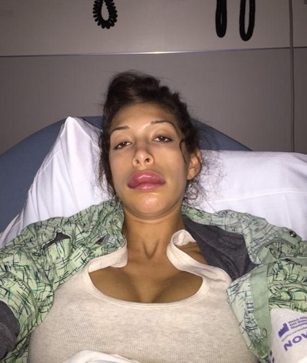 Jak dzisiaj wyglądają jej usta? (FOTO)