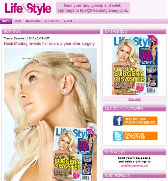 Heidi Montag: Żałuję wszystkich 10 operacji plastycznych!