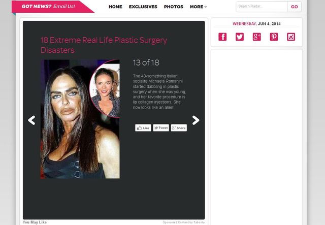 Herbuś na zagranicznym portalu: OFIARA OPERACJI plastycznych