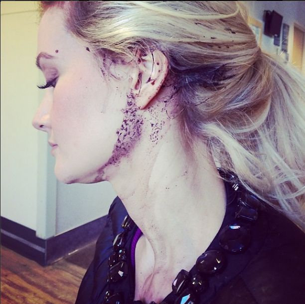 Holly Madison miała wypadek! (FOTO)