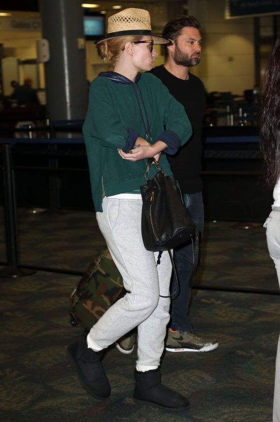 Co się stało z twarzą Iggy Azalei? (FOTO)