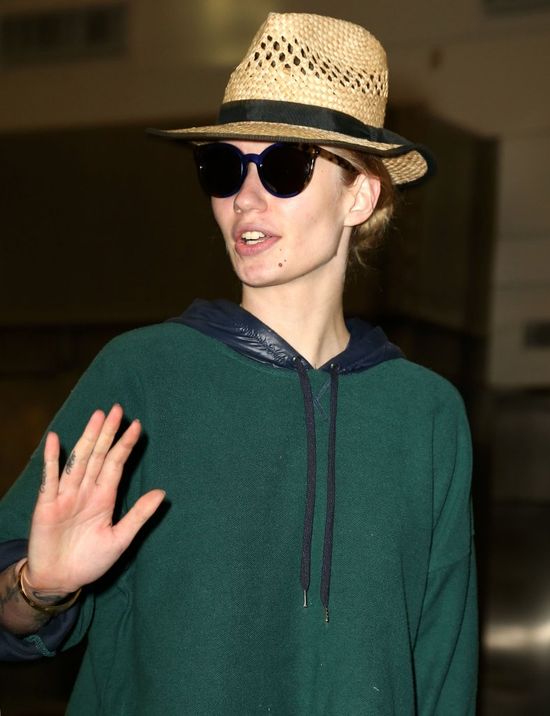 Co się stało z twarzą Iggy Azalei? (FOTO)