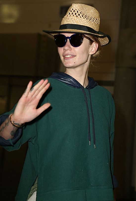 Co się stało z twarzą Iggy Azalei? (FOTO)