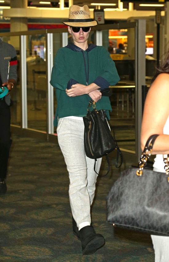 Co się stało z twarzą Iggy Azalei? (FOTO)