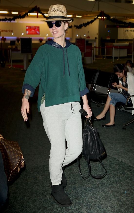 Co się stało z twarzą Iggy Azalei? (FOTO)