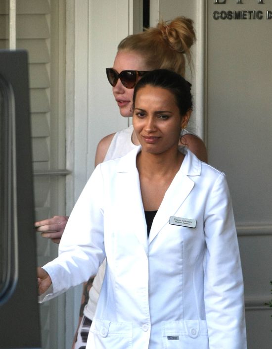 Iggy Azalea za wszelką cenę chce pozbyć się tego defektu