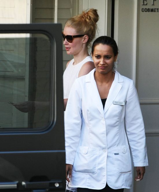 Iggy Azalea za wszelką cenę chce pozbyć się tego defektu Iggy Azalea za wszelką cenę chce pozbyć się tego defektu