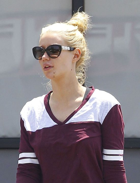 Zoperowana Iggy Azalea wciąż walczy z kompleksami (FOTO)