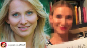 Joanna Moro przeszła operację PLASTYCZNĄ! Joanna Moro przeszła operację PLASTYCZNĄ!