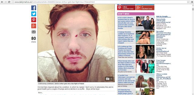 Zagraniczne media piszą o pobiciu Jamesa Arthura w Polsce Zagraniczne media piszą o pobiciu Jamesa Arthura w Polsce