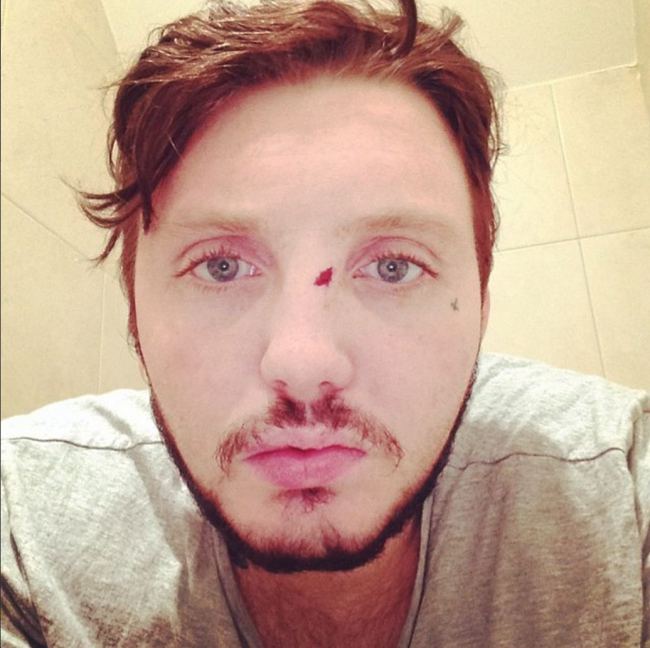 James Arthur pobity w Polsce! (FOTO) James Arthur pobity w Polsce! (FOTO)