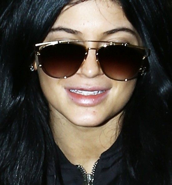 Kylie Jenner ma JESZCZE większe usta (FOTO) Kylie Jenner ma JESZCZE większe usta (FOTO)