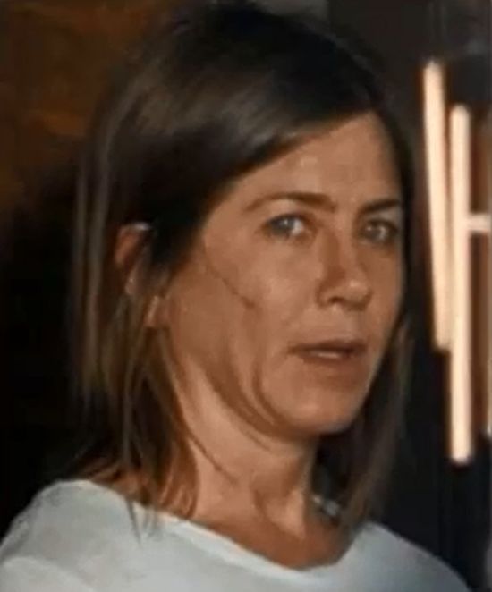 Jennifer Aniston ma na twarzy wielką szramę! (FOTO)