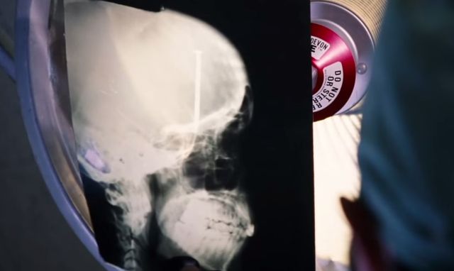 Gyllenhaal pomaga Jessice Biel pozbyć się gwoździa z głowy