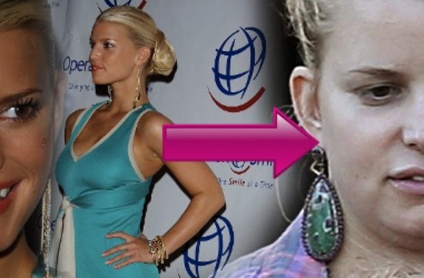 Katastrofa! Co się stało z Jessicą Simpson?! (FOTO)
