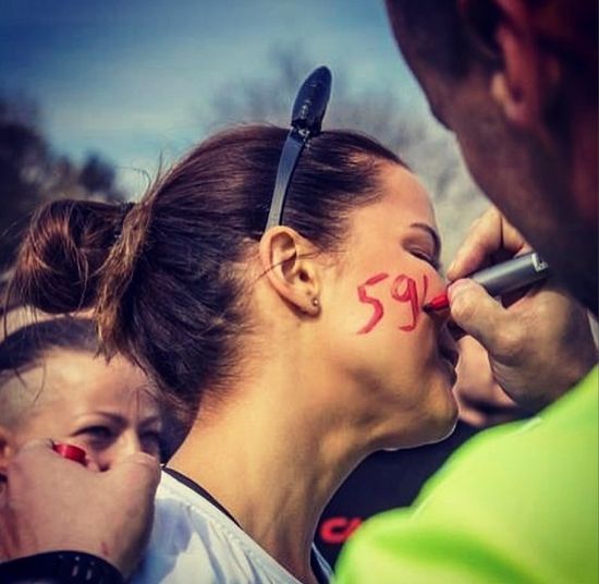 Joanna Jabłczyńska cała w siniakach! (FOTO)