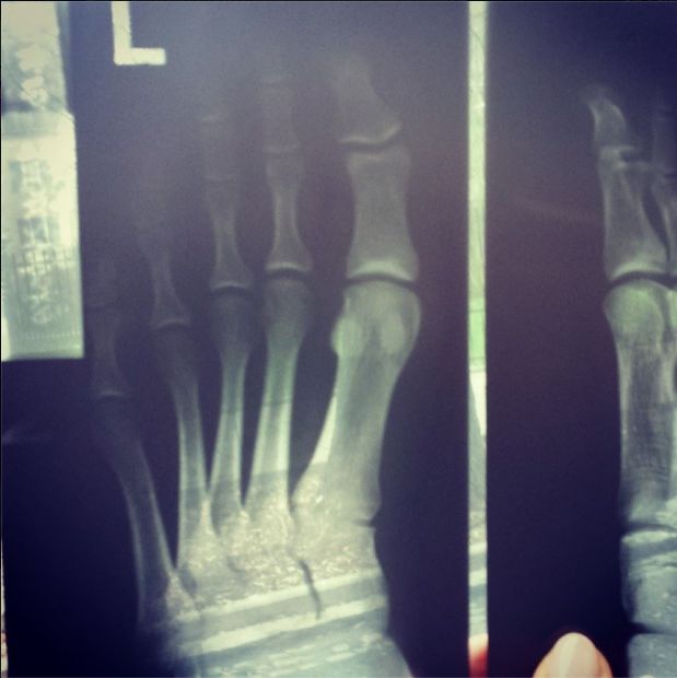 Joanna Jabłczyńska miała wypadek na planie serialu!