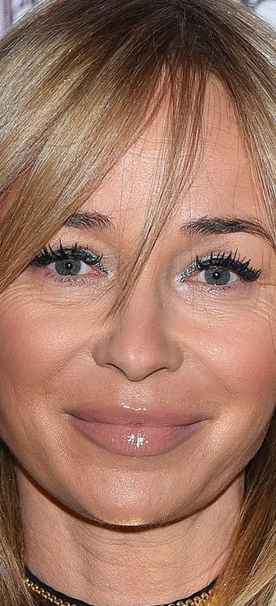 OMG! Co się stało z ustami Joanny Przetakiewicz? (FOTO)