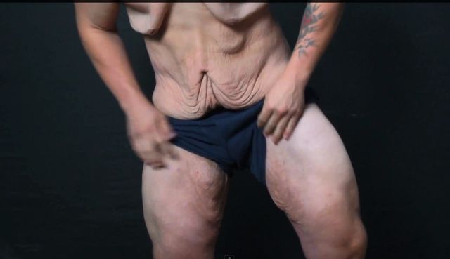 Ten Mężczyzna Schudł 73 kilogramy!