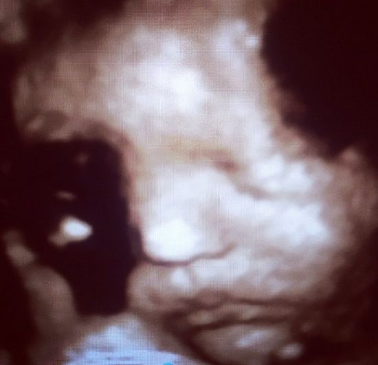 JWoww urodziła córeczkę! Czy jest zdrowa?