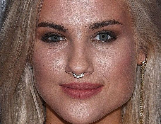 Karolina Gilon pozbyła się tego mankamentu (FOTO)