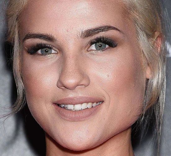 Karolina Gilon pozbyła się tego mankamentu (FOTO)