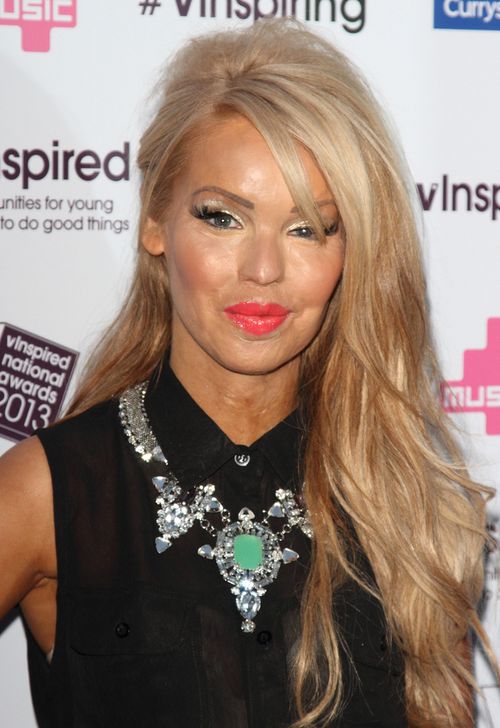 Poparzona kwasem Piper: Dawna Katie odeszła na zawsze Poparzona kwasem Piper: Dawna Katie odeszła na zawsze