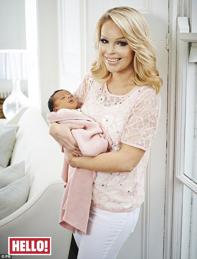 Poparzona kwasem Katie Piper pokazuje córeczkę (FOTO) Poparzona kwasem Katie Piper pokazuje córeczkę (FOTO)