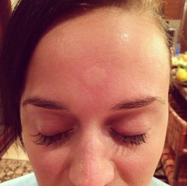 Co się stało Katy Perry? (FOTO)