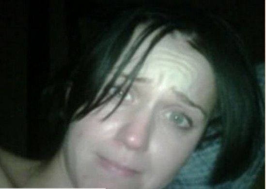 Te gwiazdy borykają się z trądzikiem (FOTO)