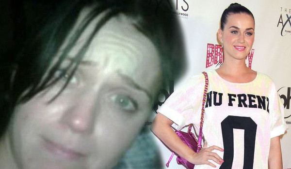 Te gwiazdy borykają się z trądzikiem (FOTO)