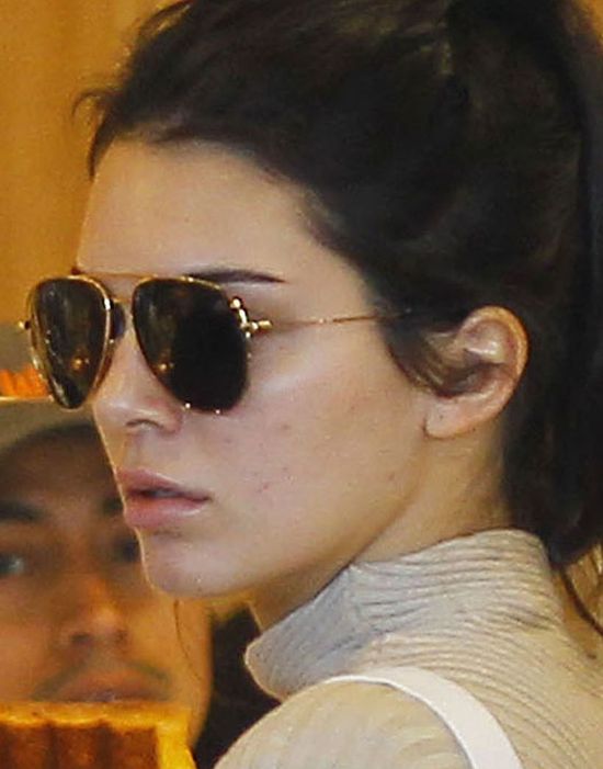 Kendall Jenner wciąż boryka się z tym problemem (FOTO)
