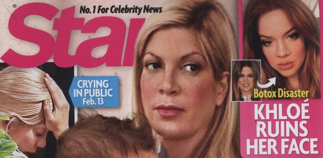 Nowa twarz Khloe Kardashian (FOTO)