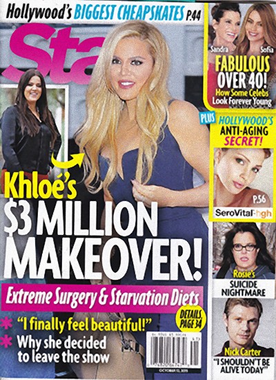 Khloe Kardashian wydała FORTUNĘ na operacje plastyczne!